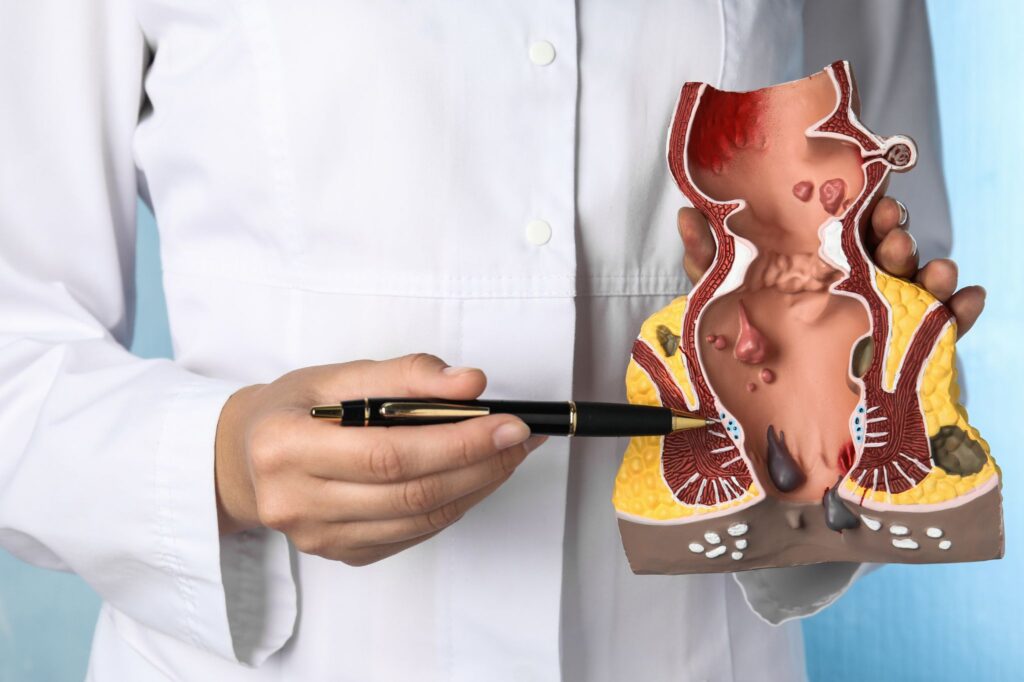 fizjoterapia anorektalna proktologiczna warszawa